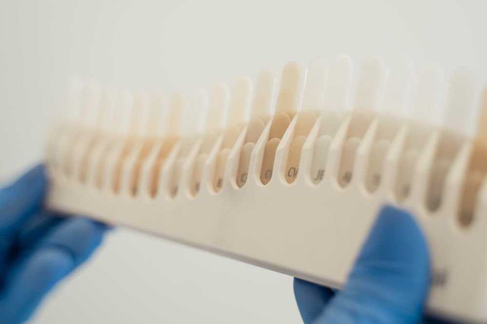 Sesión de blanqueamiento dental en la consulta