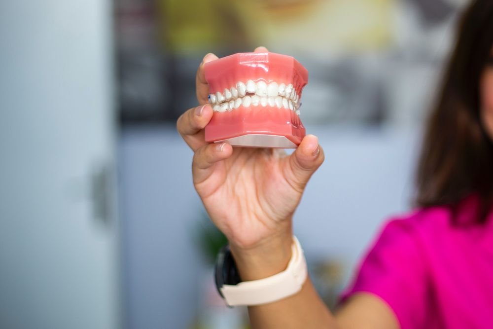 Odontóloga sosteniendo un modelo dental para explicar una corona