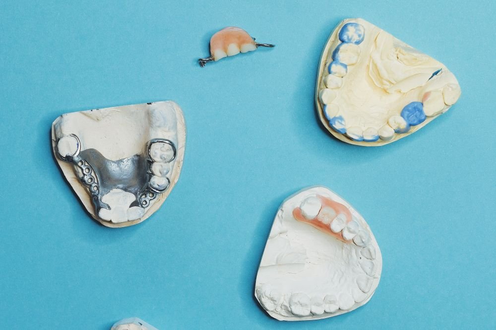 Moldes y prótesis dentales preparados en la clínica